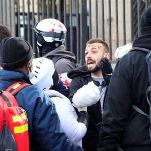 وضعت ضمادة على مقدمة ذراعه