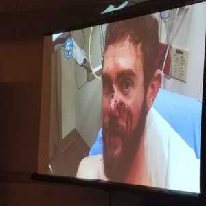 ترك الأسد المقتول جروحا كبيرة في وجه كوفمان