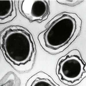 الإفراط في استخدام المضادات الحيوية يزيد مناعة البكتيريا
