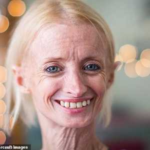 المرأة تبلغ من العمر 41 عاما.