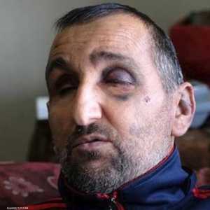 الكفيف منذر مزهر بعد اعتداء الجنود الإسرائيليين عليه