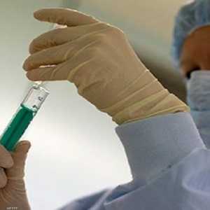 نتائج ايجابية تعزز فرص الحصول على علاج لمرض الايدز