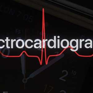 الساعة ترصد نبضات القلب على مدى واسع