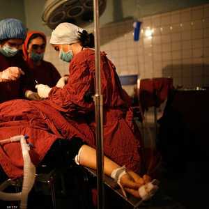 يعد "التوأم الطفيلي" حالة ولادة نادرة تمثل 1 من أصل 500 ألف