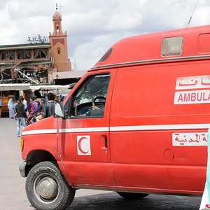 الزوج أصيب بحروق من الدرجة الثانية