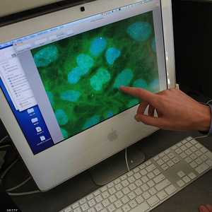 يصيب سرطان الثدي حوالي 55 ألف بريطانية في السنة