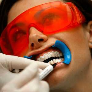 منتجات تبييض الأسنان تؤدي إلى إضعاف الأسنان