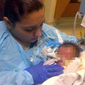 الطفل بلا جلد.. حالة نادرة في مستشفى أميركي