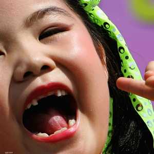 صحة الأسنان في الطفولة هي أقوى مؤشر على صحتها لدى البالغين