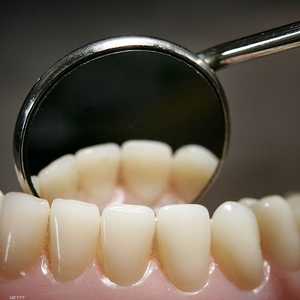 تلقي نحو 560 مريضا في بريطانيا رسالة تحذير من عيادة أسنان