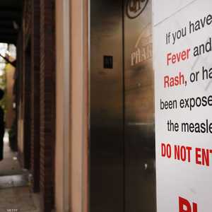 أميركا تسجل أعلى عدد لحالات الحصبة منذ القضاء على الفيروس