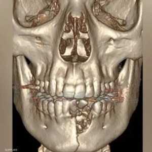 الشاب تعرض لكسر في الفك السفلي