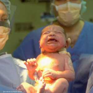 ارتفاع معدل الولادات القيصرية بالولايات المتحدة