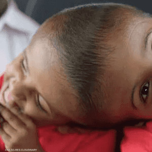 تطلب الفصل ثلاث عمليات جراحية