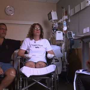 فقد السيدة ترينر أطرافها بسبب لعاب الكلب