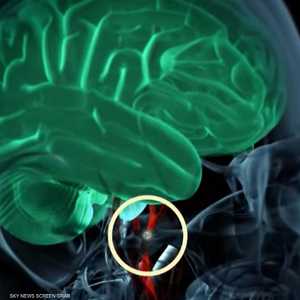 الذكاء الإصطناعي يسهم بالاكتشاف المبكر للأمراض الصعب