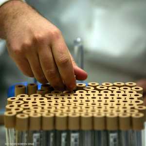 الحمض النووي لحل لغز رفات جنرال فرنسي قتل في موسكو