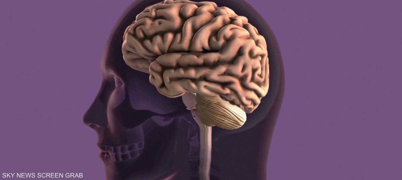 الزهايمر.. علاج بثمن زهيد