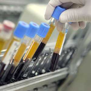 الشاب أجرى تجارب على عينات من دمه - أرشيفية