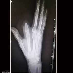 طبيب قال إن القرار المؤلم لم يكن ضروريا بالمرة