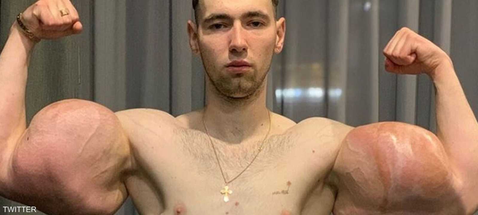 "بوباي روسيا" مستعرضا عضلاته