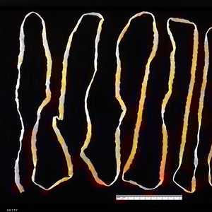 دودة شريطية تم استخراجها من جسم إنسان