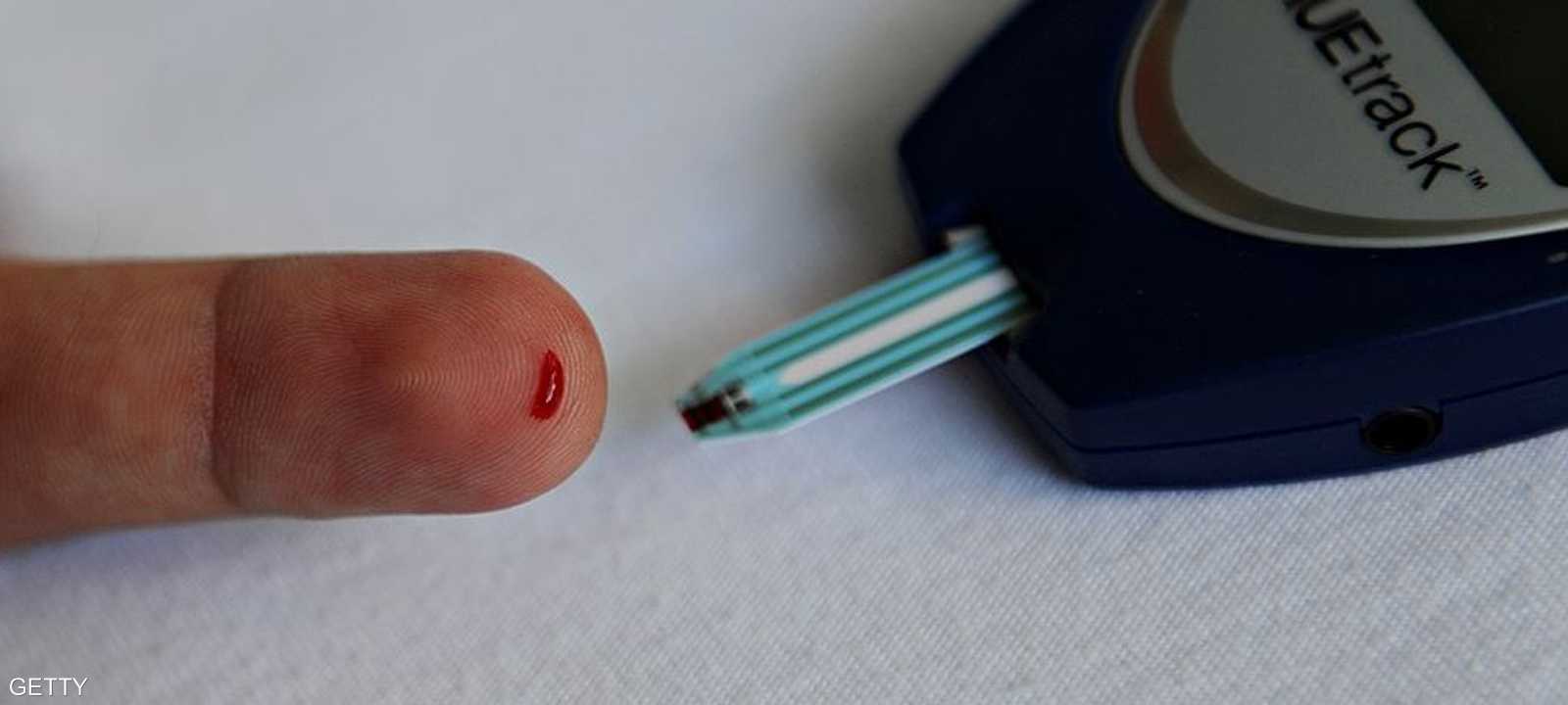 الدراسة أجريت في الولايات المتحدة