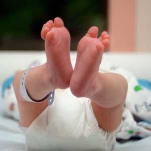 ولادة أثناء الغيبوبة