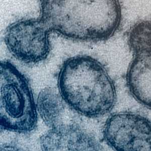 منظمة الصحة العالمية: تطوير لقاح سيستغرق عاما على الأقل