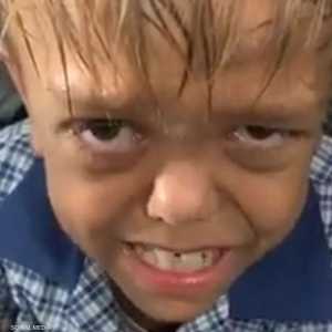 كوادن بايلز يعاني من مشاكل في النمو "التقزم"