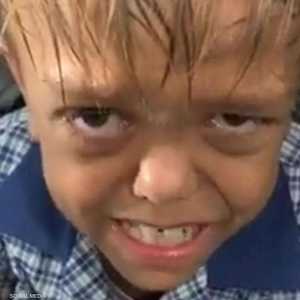 فتى أسترالي تعرّض للتنمّر يتبرّع بمبلغ 475 ألف دولار