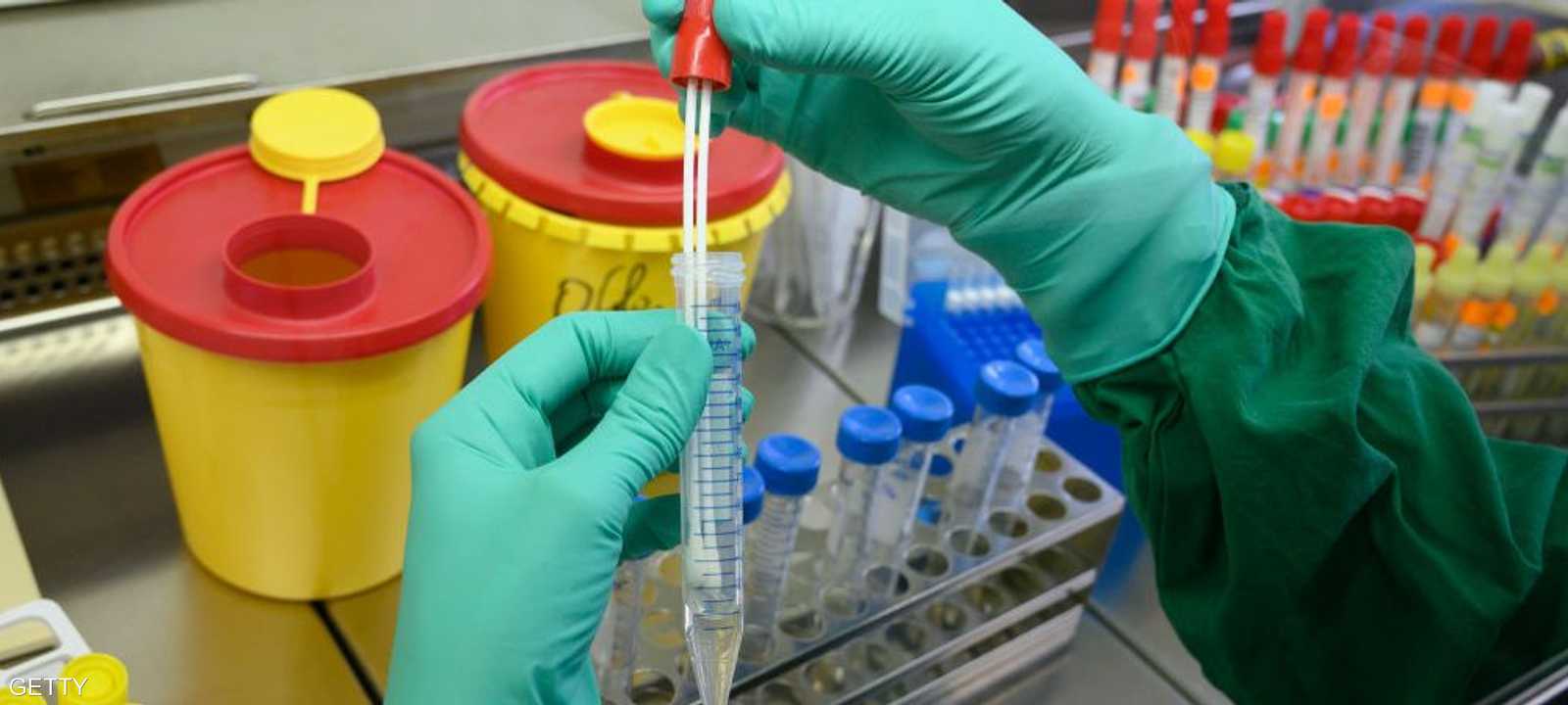 المكافأة تأتي تشجيعا من المنظمة للبحث العلمي التطبيقي