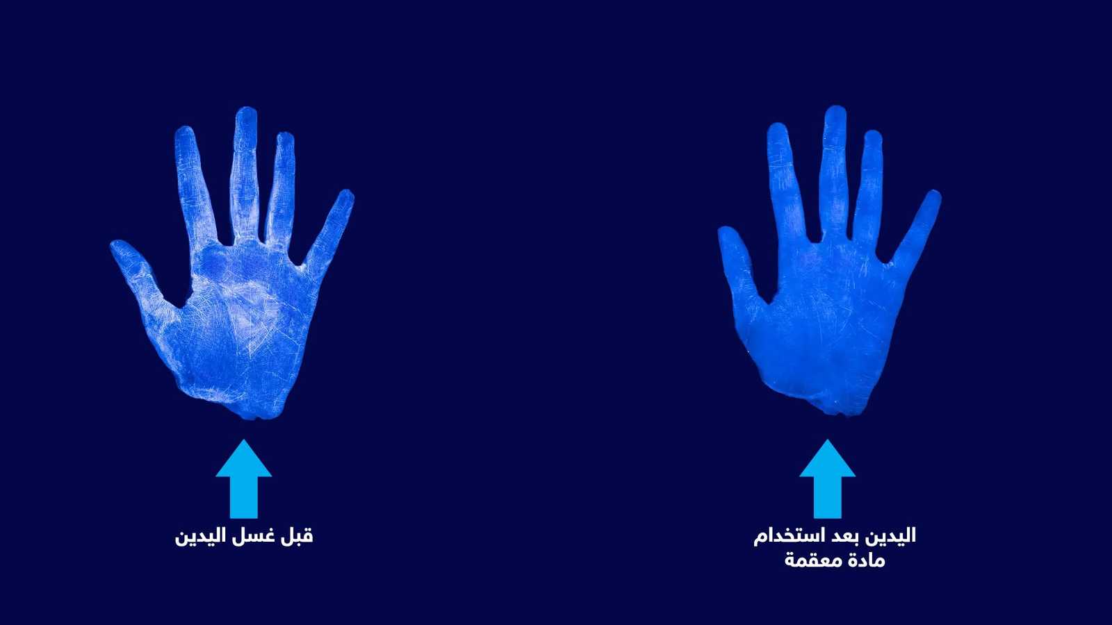 الفرق في اليد بعد استخدام مادة معقمة