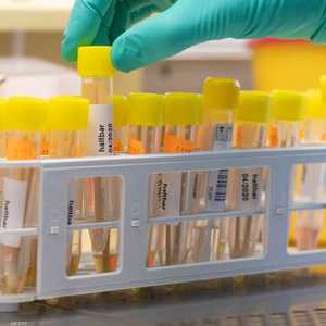 المريض بكوفيد 19 لا ينشر العدوى بعد 10 أيام وفقا للدراسة