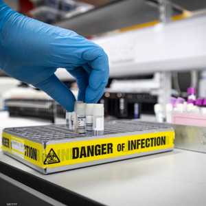 الإمارات: 45 إصابة جديدة بكورونا وشفاء 3 حالات - أرشيفية