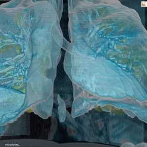 جامعة جورج واشنطن توضح ما الذي يفعله كورونا بالرئتين