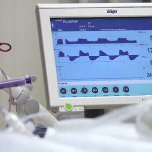 العالم يجاهد في البحث عن الأجهزة الطبية في زمن كورونا