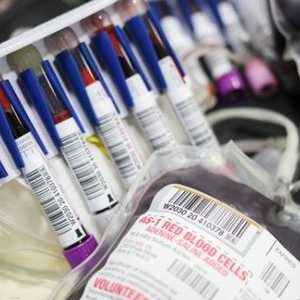 التكنولوجيا تساعد في مجال الفحوص المخبرية لمكافحة كورونا