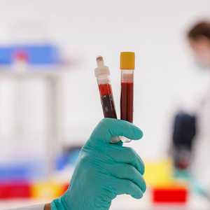 فحوص الأجسام المضادة تساعد في عودة النشاط الاقتصادي