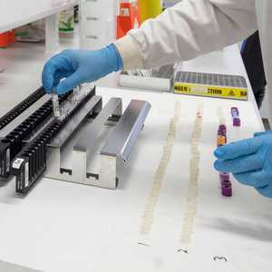 العلماء يسابقون الزمن لاكتشاف لقاح لكورونا