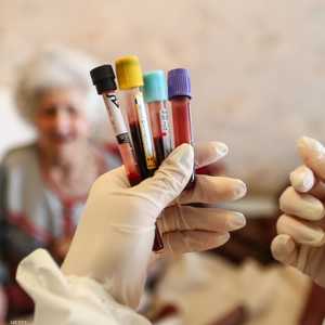 جلطات الدم إحدى المضاعفات الخطيرة لكورونا