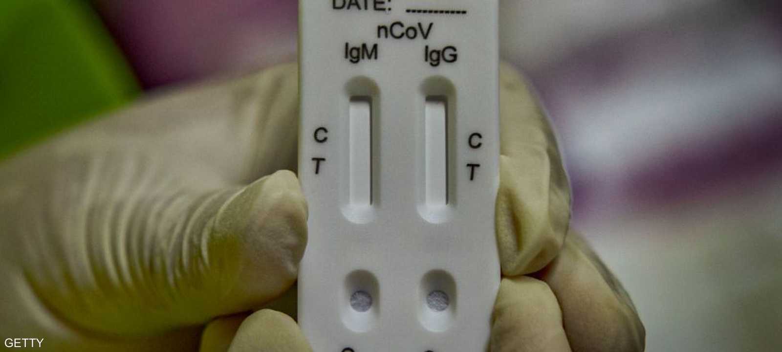 أجهزة اختبارات فيروس كورونا المنزلية قد تؤدي إلى سوق سوداء