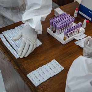 معدات الكشف عن فيروس كورونا صارت متاحة