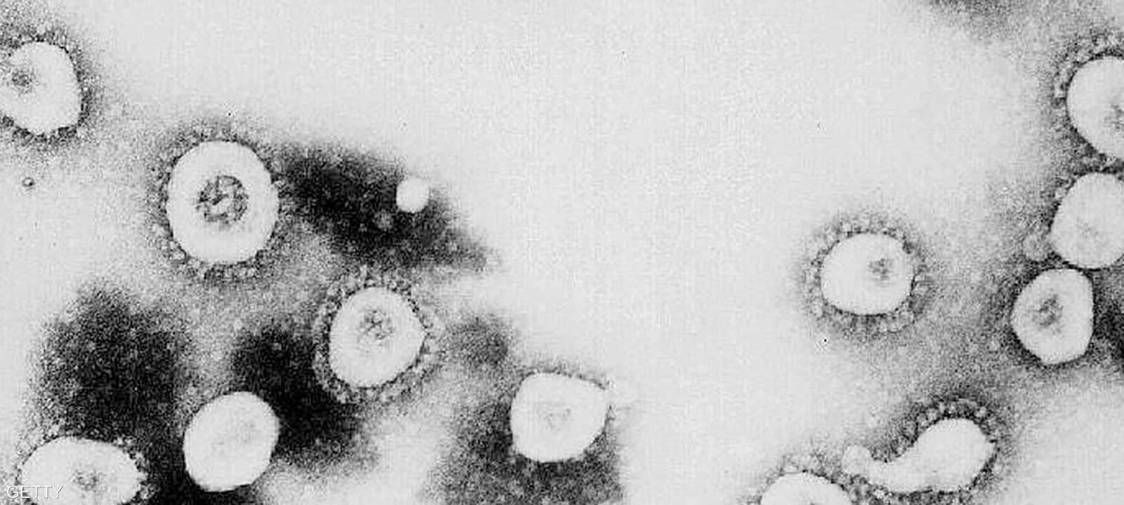 فيروس كورونا.. دراسة طبية جديدة