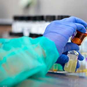 لقاح كورونا.. متى يظهر؟