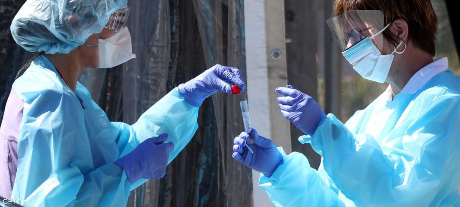 الدراسة أجريت على 19 مريضا ولا يمكن تعميمها.