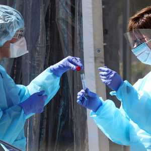 الدراسة أجريت على 19 مريضا ولا يمكن تعميمها.