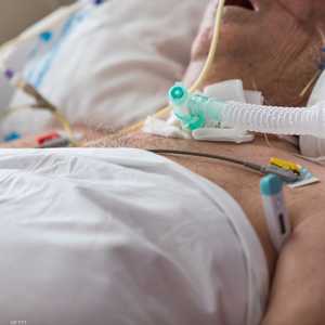 الدراسة أجريت على عدد محدود من المرضى