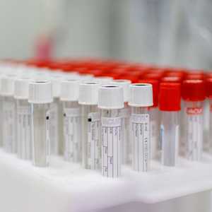 شركات الأدوية تسابق الزمن لانتاج لقاح للوباء