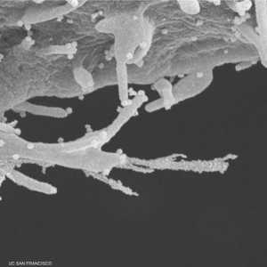 صورة مجهرية تظهر مخالب الخلايا المصابة بكورونا